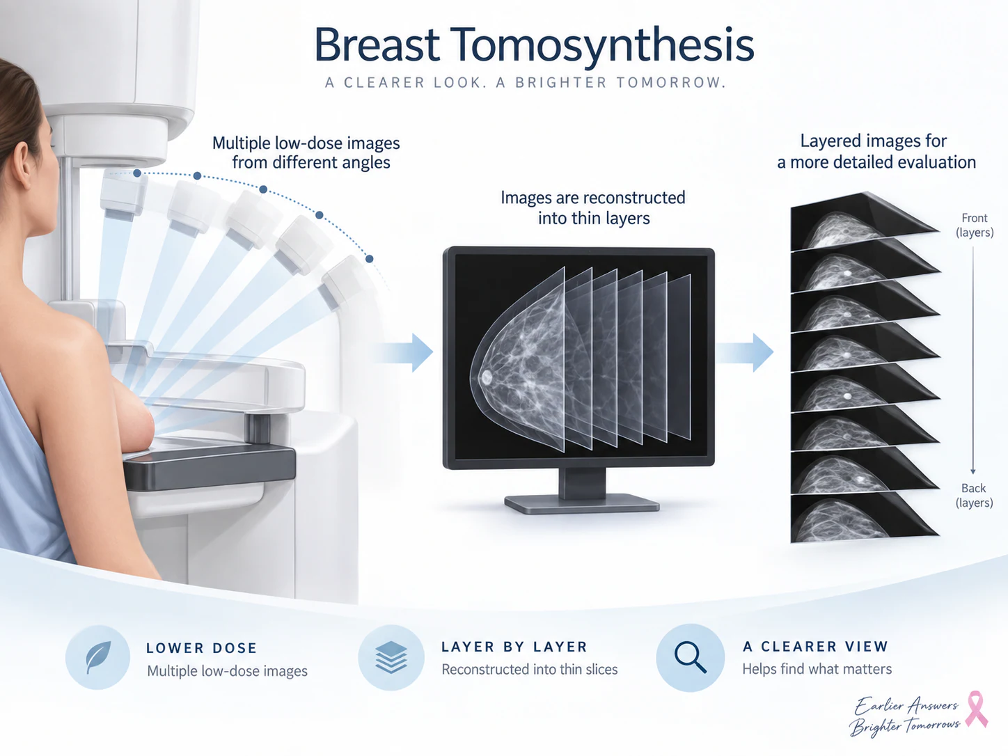 Layer-by-layer breast tomosynthesis imaging